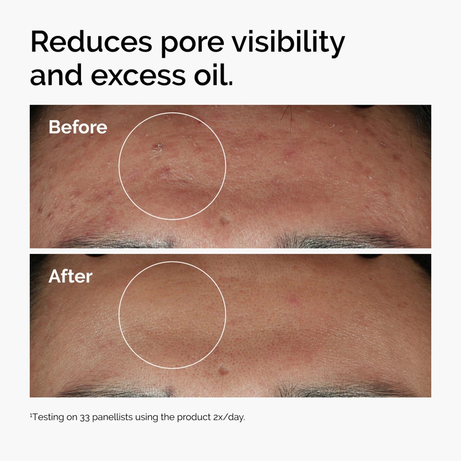 The Ordinary Niacinamide 10% + Zinc 1% Serum 30ml - BEAUTINA