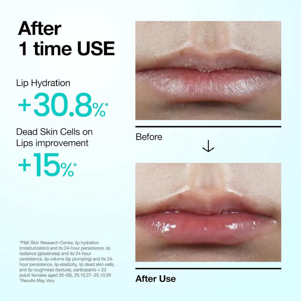 PDRN Hyaluron Lip Serum 10ml – Hydrating & Plumping Lip Care