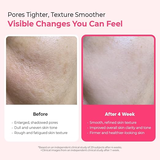 Cemenrete Cyano Pink Spicule Serum | Brightening & Skin Barrier Repair Serum