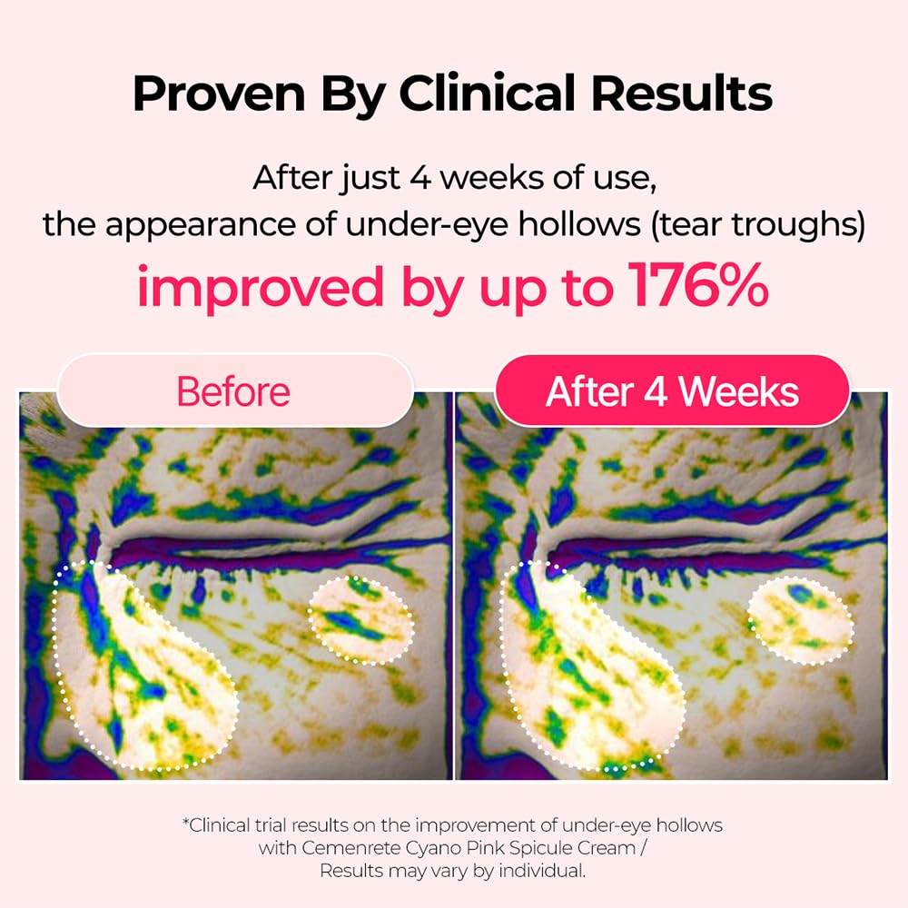 Calcium B12 Spicule Cream | Skin Barrier Repair & Firming Cream