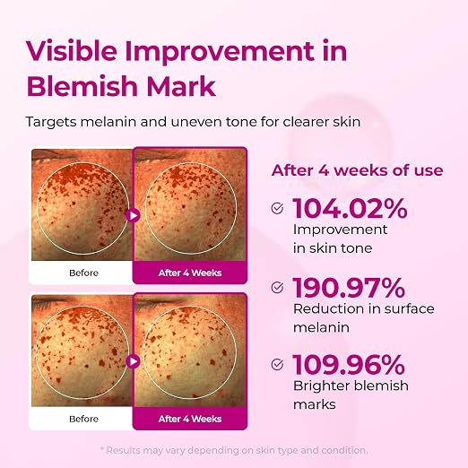 Calcium Cemenrete Picotonic Shot | Firming & Skin Barrier Boosting Ampoule